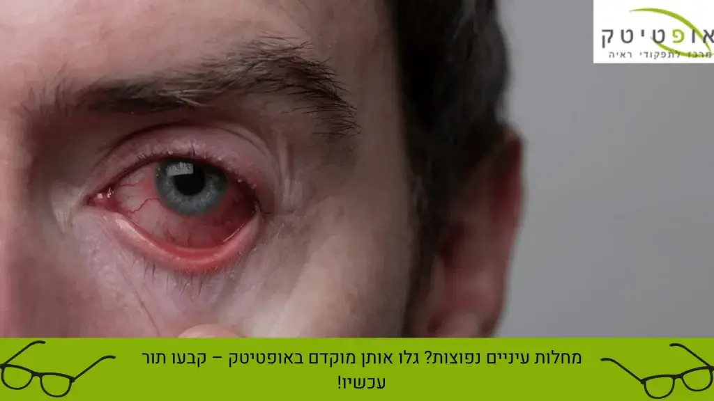 מחלות עיניים נפוצות